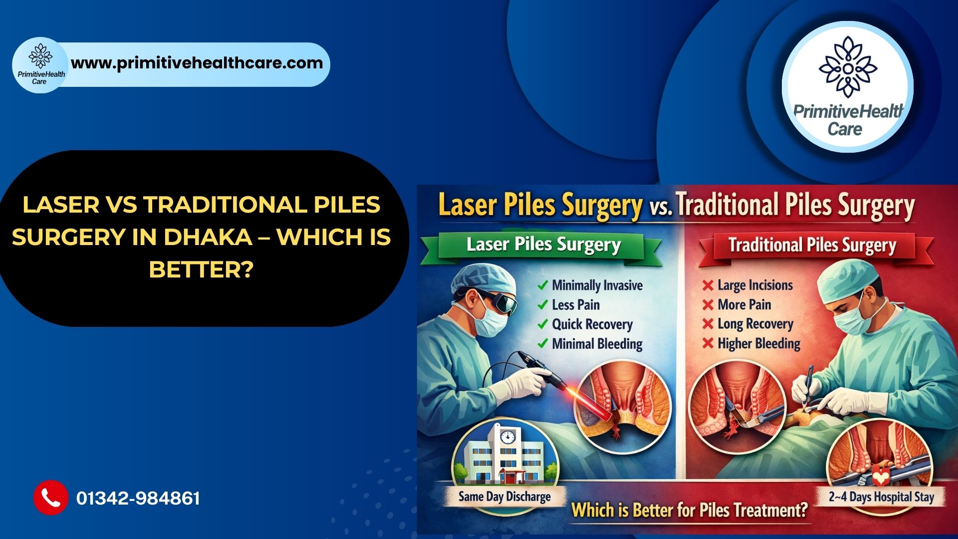 Laser vs Traditional Piles Surgery in Dhaka – Which Is Better?